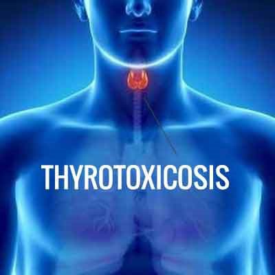 щитовидная железа тиреотоксикоз 