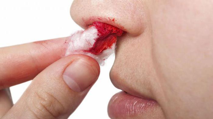 Как вызвать кровь из носа специально и безопасно