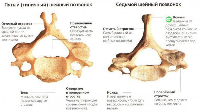 6 шейный позвонок