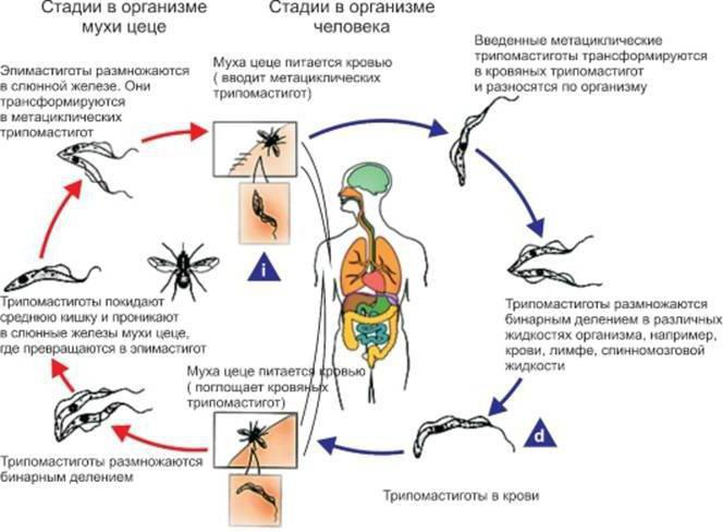 африканский трипаносомоз