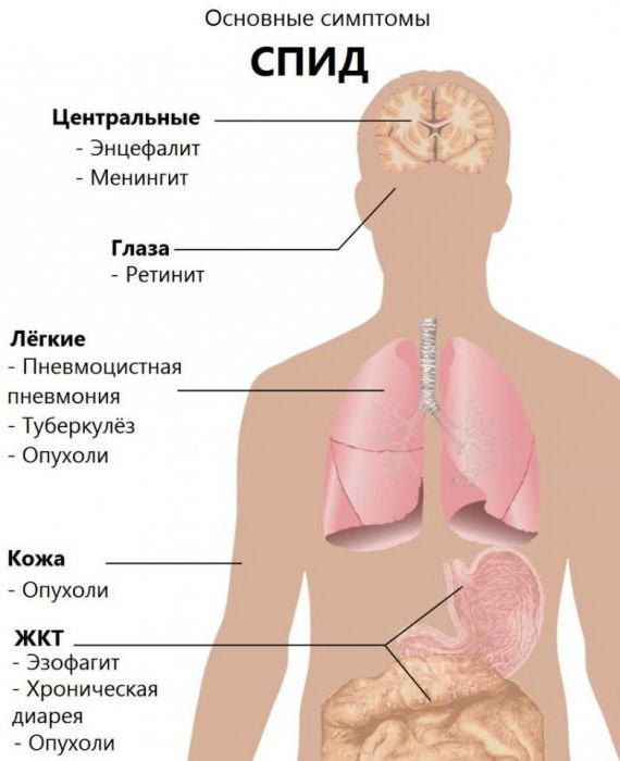 возбудитель вируса спида