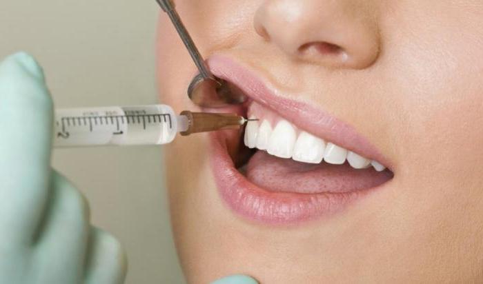 анестезия в стоматологии 