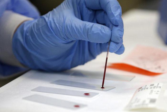 Общий анализ крови при ВИЧ: назначение и изменения показателей