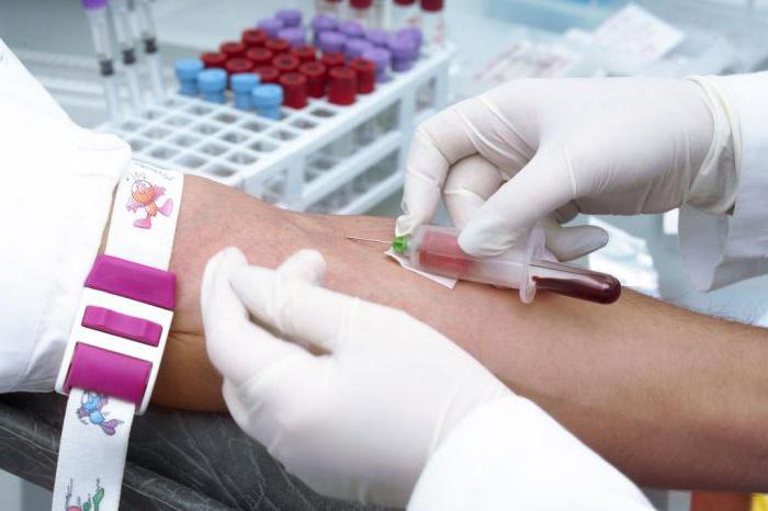 Что показывает анализ крови на ПЦР? Как подготовиться к анализу