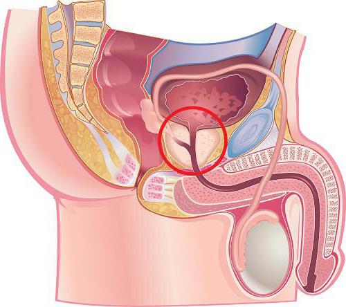 секрет предстательной железы анализ расшифровка