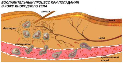 воспаление зуба