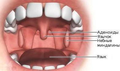 где находятся аденоиды 