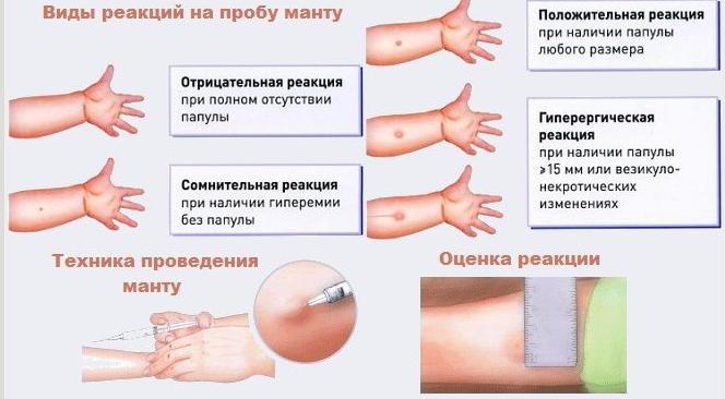 что такое норма реакции 