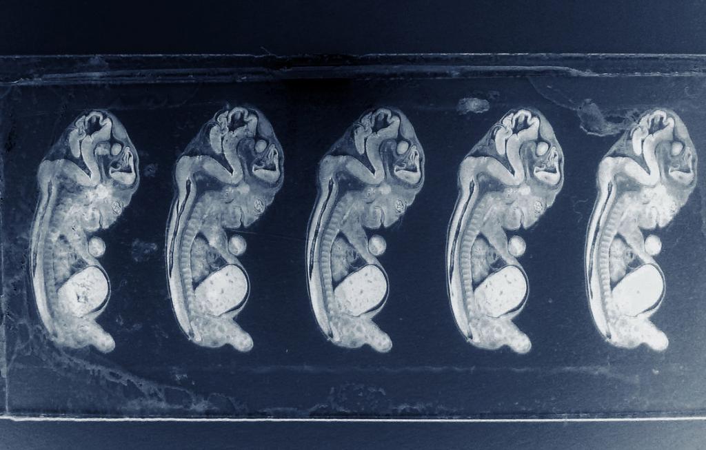 Фото человеческих эмбрионов