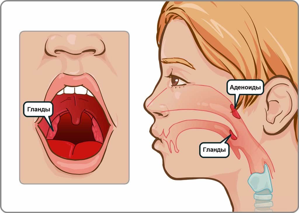 где расположены аденоиды