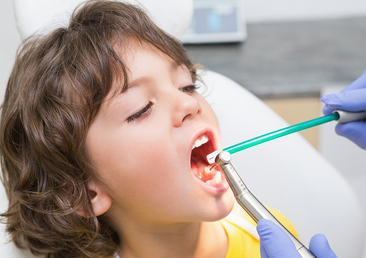 Наращивание зубов у детей