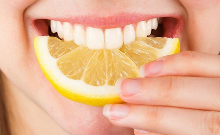 желтые зубы у женщины