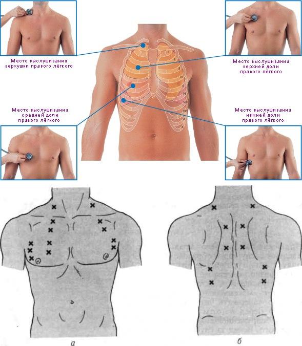 аускультация легких