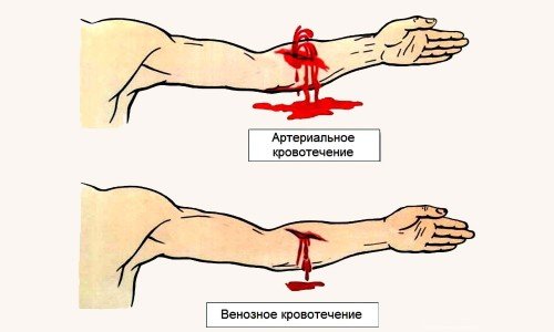 Какая кровь артериальная