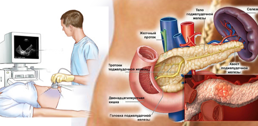 УЗИ поджелудочной железы