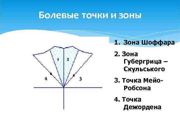 Зоны болезненности