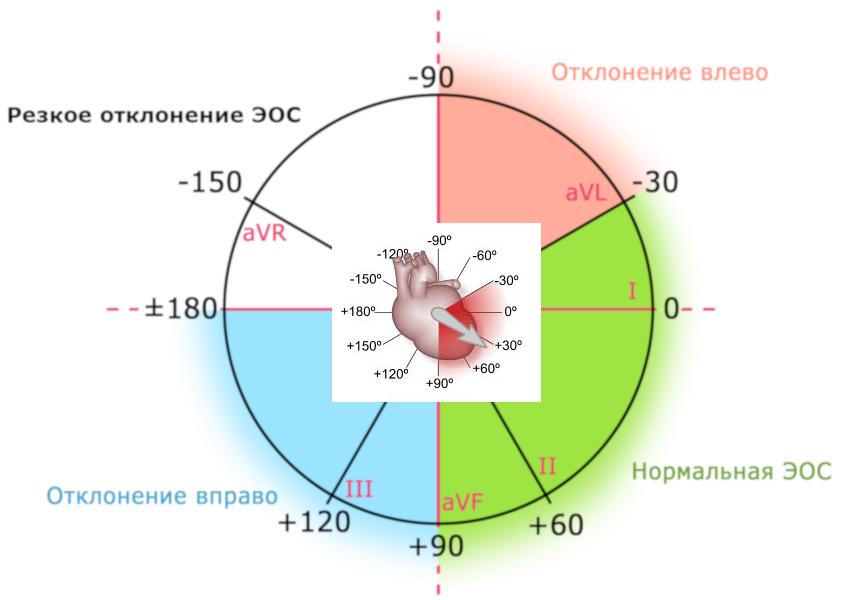 Вертикальное положение ЭОС - что это такое и чем грозит?