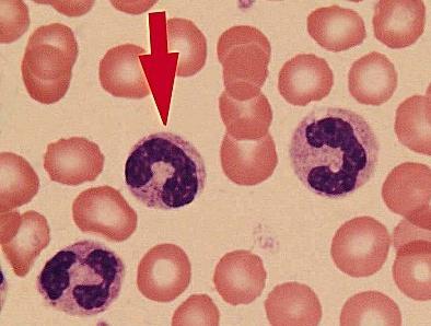 сегментоядерные нейтрофилы