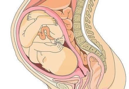 плацента по задней стенке матки
