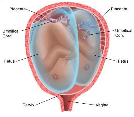 Беременность по неделям двойней