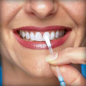 отбеливание зубов в домашних условиях отзывы
