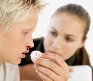 Причины носовых кровотечений у детей