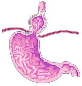 Диета при грыже пищевода