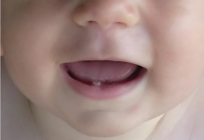 Первый Зуб У Ребенка Поздравления