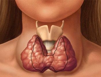 щитовидка симптомы