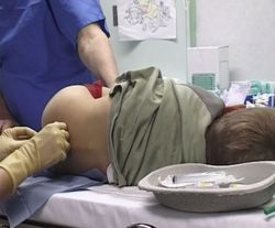 Сухие мозоли причины лечение