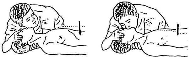 как правильно делать искусственное дыхание