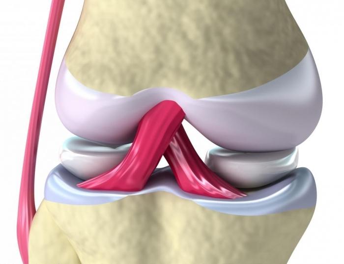 разрыв связок коленного сустава