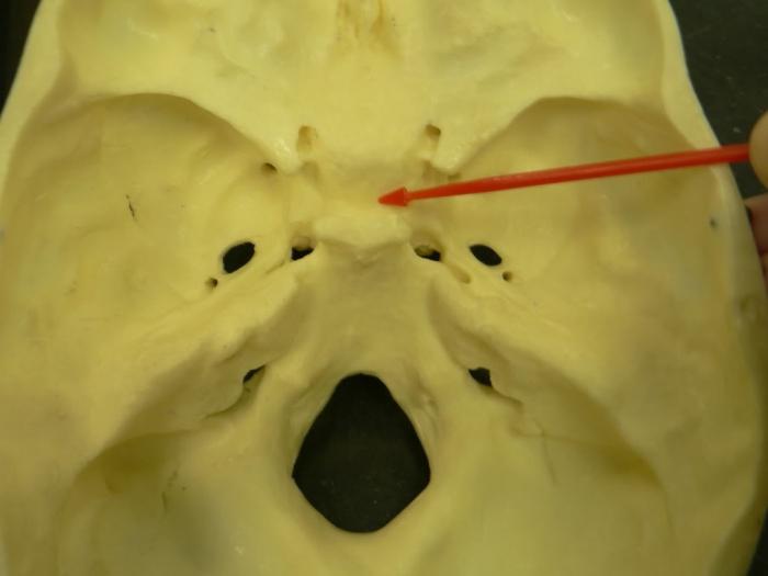 Формирующееся турецкое седло в головном мозге. Кость черепа турецкое седло. Турецкое седло в черепной коробке. Турецкое седло анатомия черепа. Турецкое седло кость анатомия.