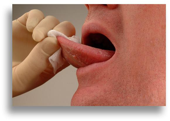 Что делать опух язык