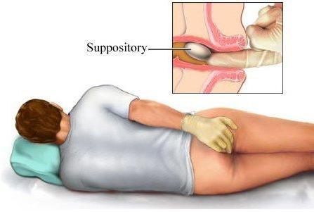 Как избавиться от геморроя