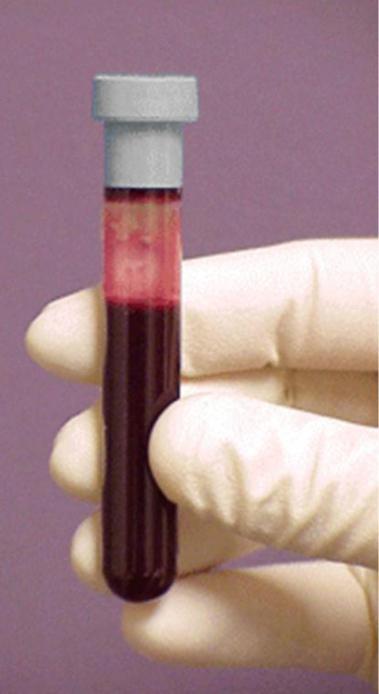 что такое биохимический анализ крови