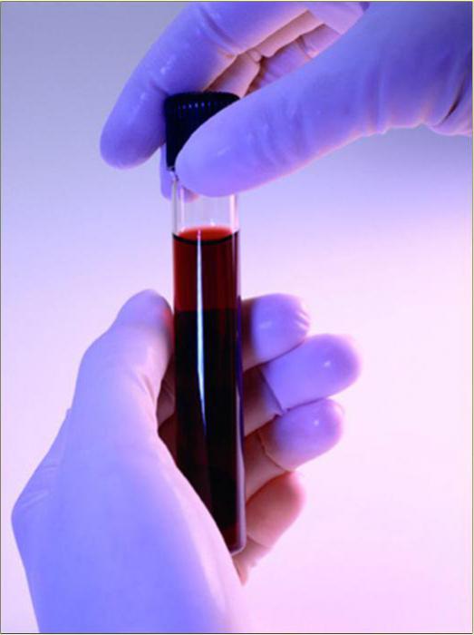 анализ крови биохимия расшифровка