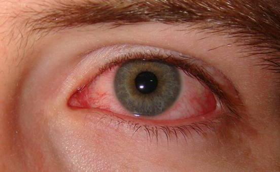 капли для глаз противовоспалительные