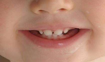 зубы у детей фото