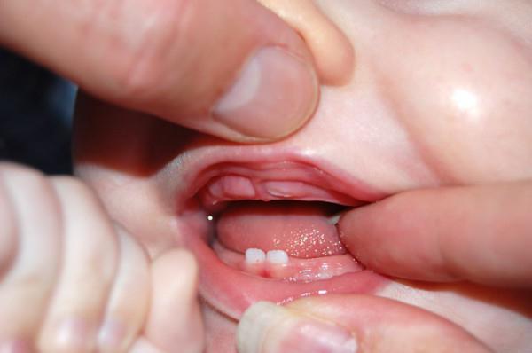 первые зубы у детей 