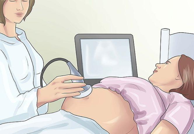 аппендицит при беременности, симптомы