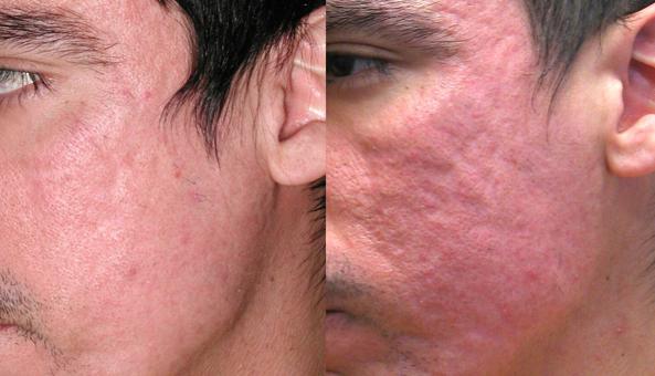 Как успокоить кожу: процедуры и средства, успокаивающие кожу