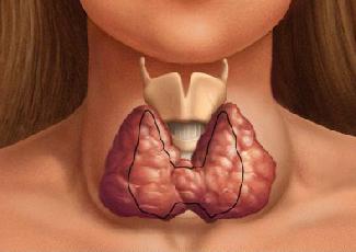Какое лечение при заболевании щитовидной железы thumbnail