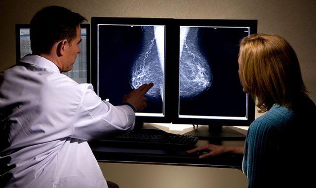 Рак грудины – симптомы, первые признаки рака молочной железы