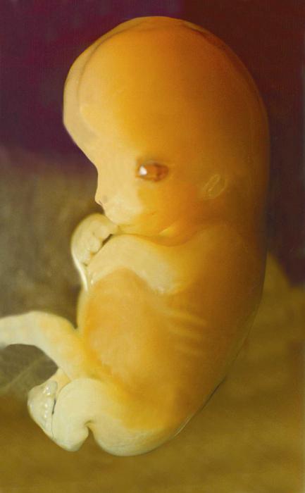 Как Выглядит Эмбрион В 6 Недель Фото