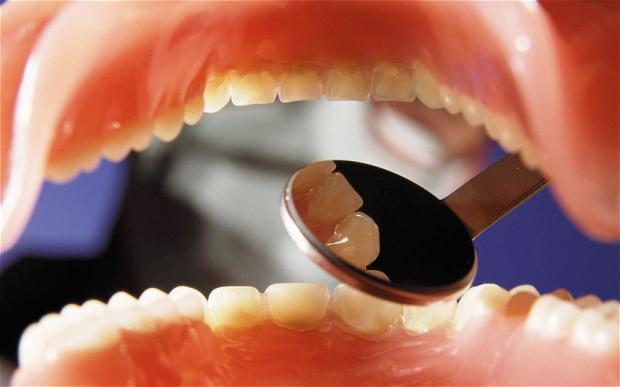 гигиеническая чистка зубов отзывы 