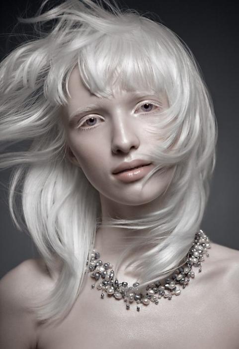 альбиносы люди красивые