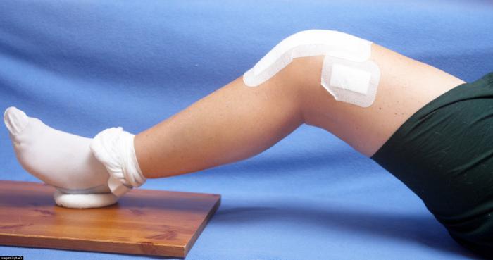 народное лечение остеоартроза коленного сустава 