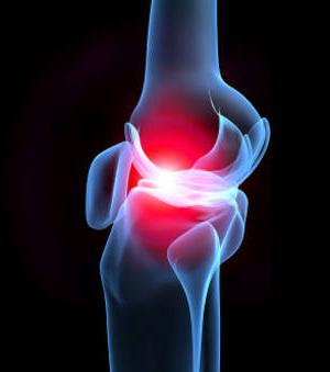 деформирующий артроз коленного сустава лечение