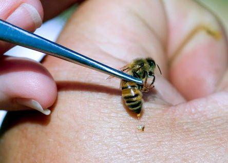лечение пчелиными укусами